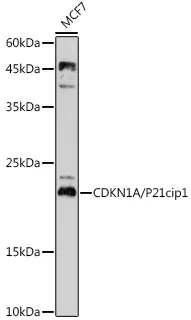 CDKN1A/p21CIP1 Polyclonal Antibody - image 1