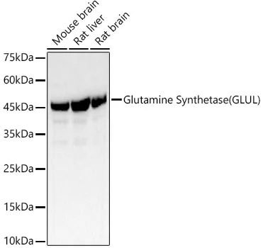 Glutamine Synthetase Polyclonal Antibody - image 1
