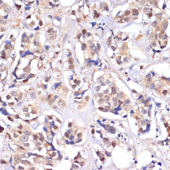 MST1/MST1/MST1/MST1/STK4 Polyclonal Antibody - image 1