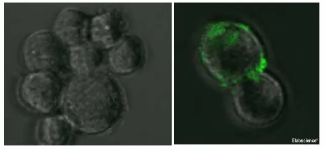 SARS-COV-2 Spike Monoclonal Antibody (2019-nCoV) - image 1