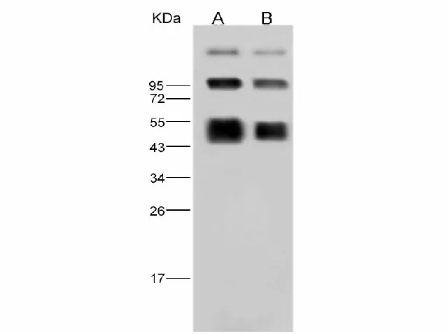 Anti-Dengue virus DENV-2 (Strain New Guinea C) NS1 Polyclonal Antibody - image 1