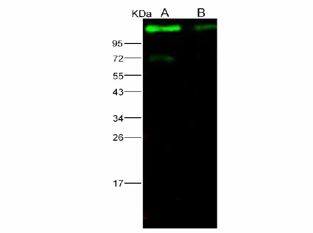 Anti-Ebola virus EBOV (Subtype Sudan, strain Gulu) Glycoprotein/GP1 (mucin domain deleted) Monoclonal Antibody - image 1