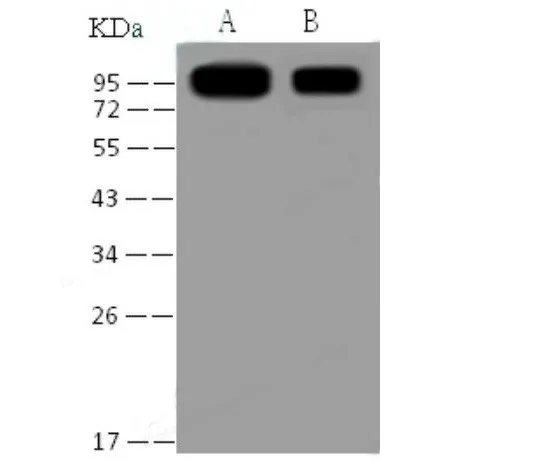 Anti-SARS-CoV Spike S1 Monoclonal Antibody - image 1
