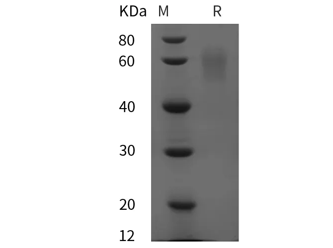 Recombinant Human SerpinA6/CBG protein (His tag) - image 1