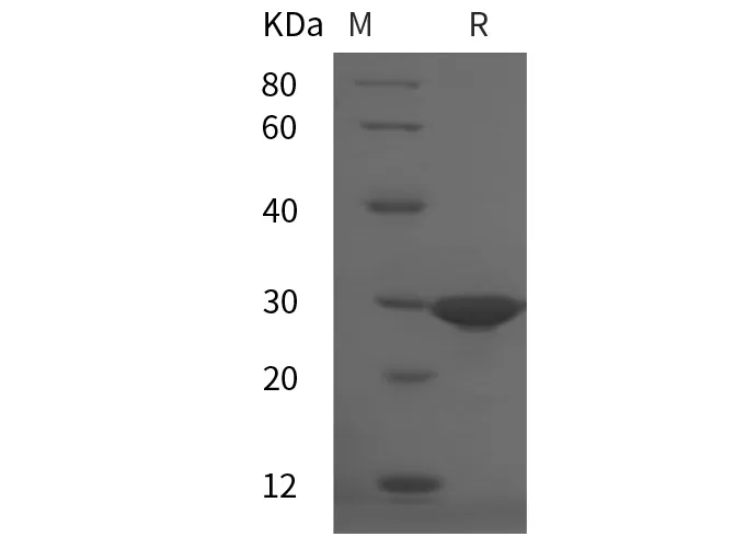Recombinant Human HMGB1 protein (His tag) - image 1