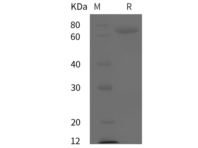 Recombinant Mouse Alpha-Fetoprotein/AFP protein (His tag) - image 1