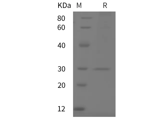 Recombinant Mouse CRP/C-Reactive protein (His tag) - image 1