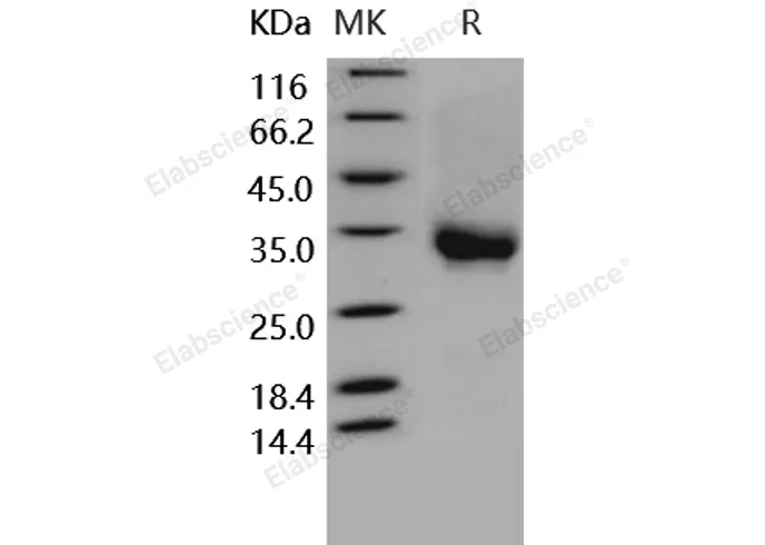 Recombinant Human CD32a/FCGR2A Protein (167 His, His&AVI Tag), Biotinylated - image 1