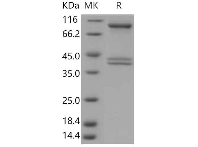 Recombinant Human AMPK (G1/B1/A2) Heterotrimer Protein - image 1