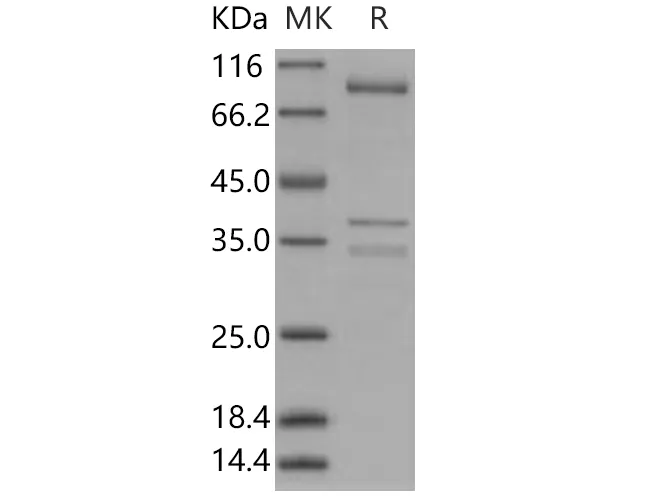 Recombinant Human AMPK (G1/B2/A1) Heterotrimer Protein - image 1