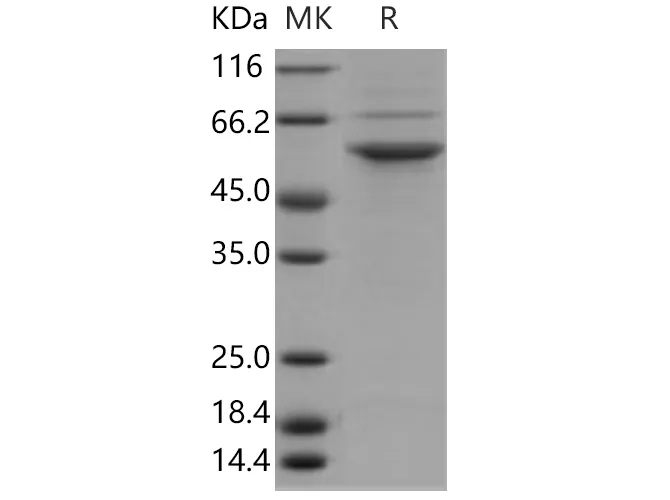 Recombinant Human STK24/MST3 Protein (His Tag) - image 1