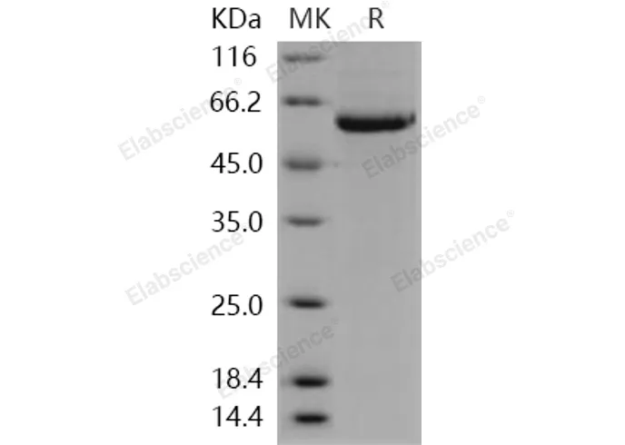 Recombinant Human STK4/MST1 Protein (His Tag) - image 1