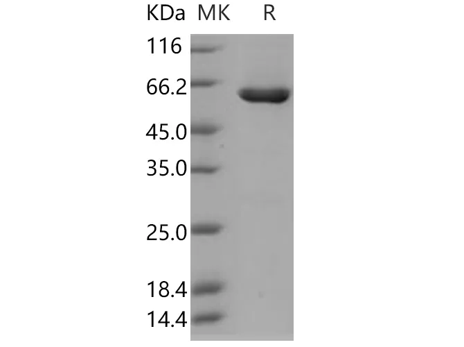 Recombinant Human CSNK2A2/CK2A2 Protein (His & GST Tag) - image 1