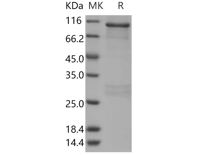 Recombinant Human RSK3/RPS6KA2 Protein (GST Tag) - image 1