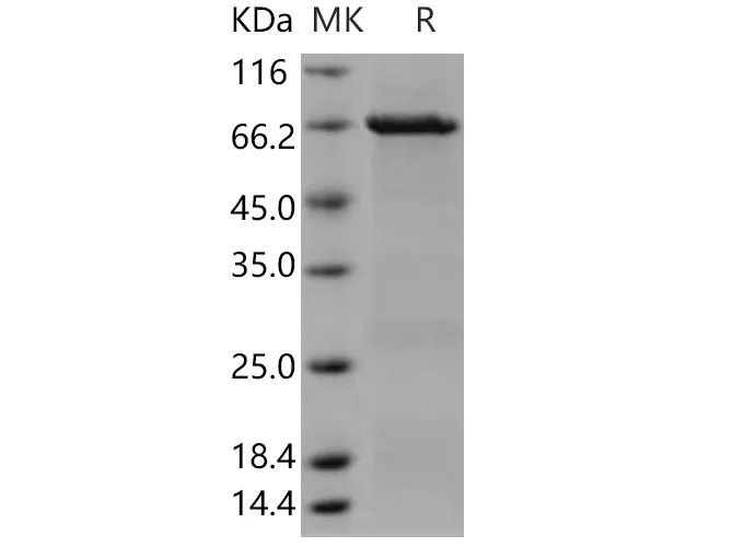 Recombinant Human CSK/C-Src kinase Protein (GST Tag) - image 1