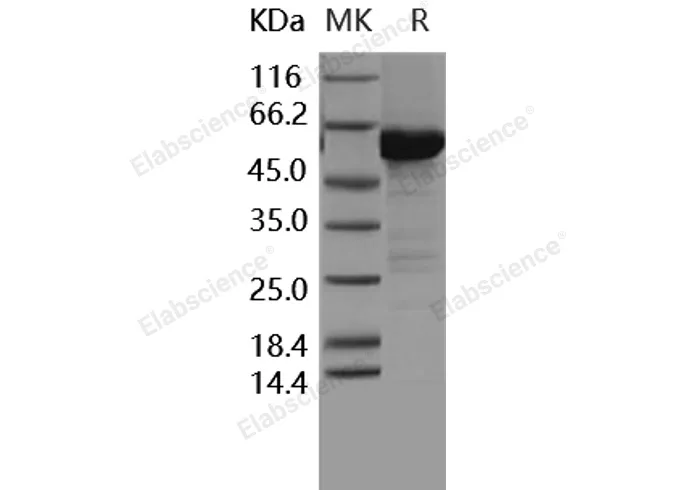Recombinant Human MKK6 Protein (207 Ser/Asp, 211 Thr/Asp, His & GST Tag) - image 1