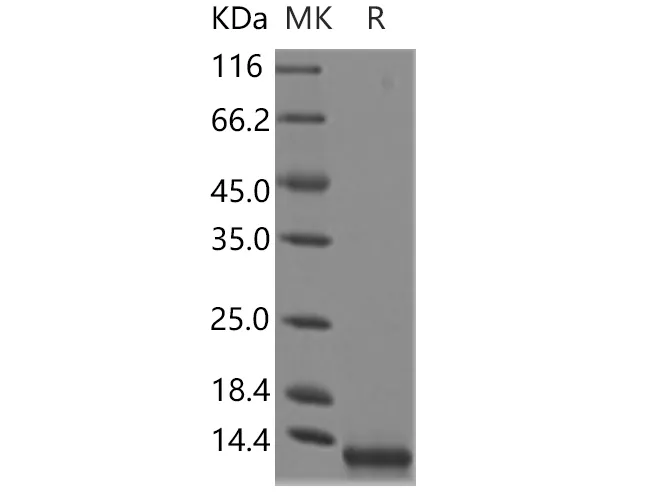 Recombinant Human CCL8/MCP-2 Protein (Yeast, His Tag) - image 1