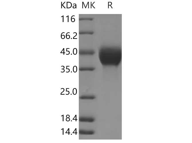 Recombinant Human TGFB1 (LAP)/TGF-beta 1 Protein (His Tag) - image 1