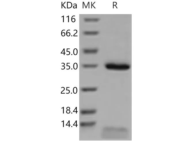 Recombinant Human FCGRT & B2M Heterodimer Protein - image 1