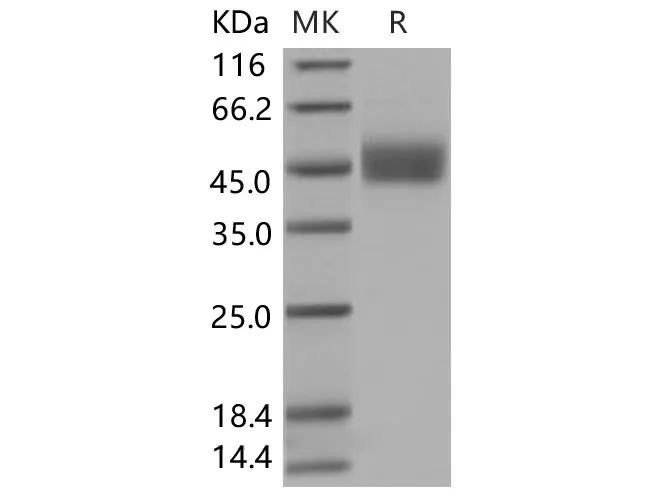 Recombinant Human FSTL1 Protein (His Tag) - image 1
