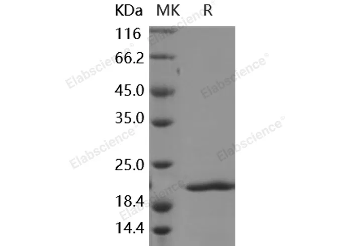 Recombinant Human FGF8a/FGF-8a Protein - image 1