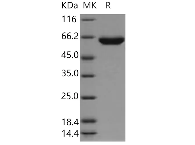 Recombinant Human TPP1/CLN2 Protein (His Tag) - image 1