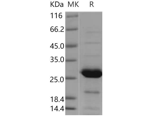 Recombinant Human PSPH Protein - image 1