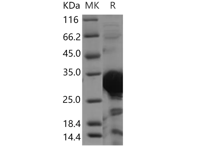 Recombinant Human PHYH Protein - image 1