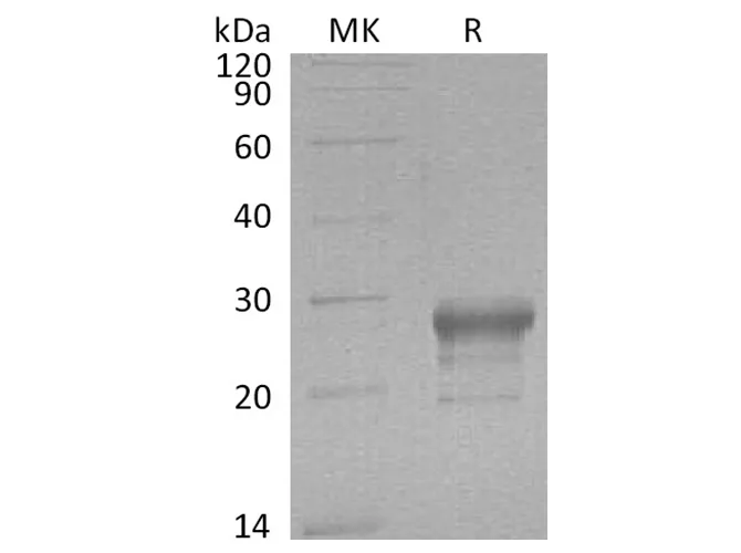 Recombinant Human PGD2 Synthase/PTGDS Protein (His Tag) - image 1