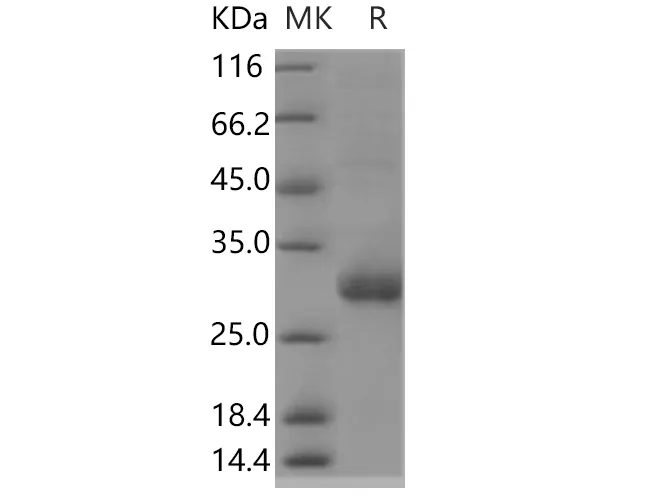 Recombinant Human TMED1 Protein (His Tag) - image 1