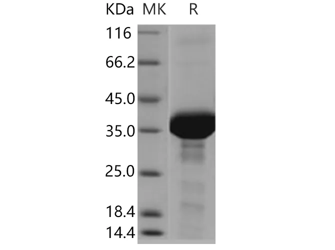 Recombinant Human FDPS Protein (His Tag) - image 1