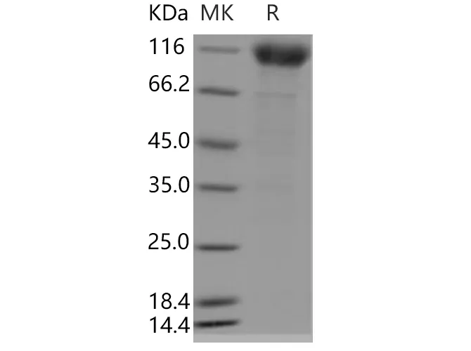 Recombinant Human IFNAR1/IFNAR Protein (Fc Tag) - image 1