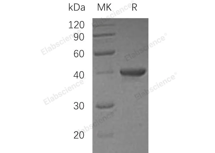 Recombinant Human UBE2I/UBC9 Protein - image 1