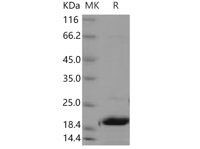 Recombinant Human UBE2M/UBC12 Protein - image 1