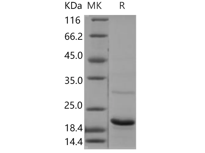 Recombinant Human UBE2G1 Protein - image 1