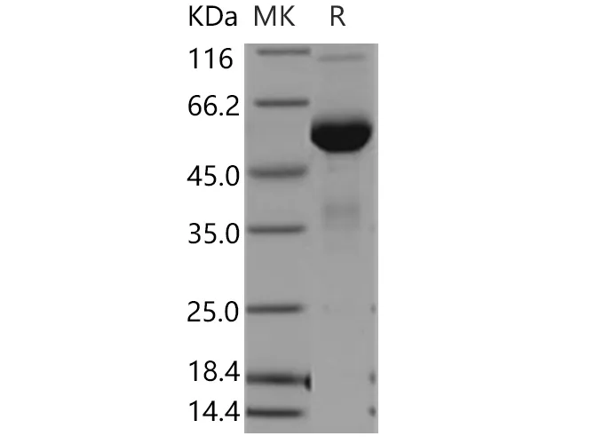 Recombinant Human Mesothelin/MSLN Protein (Fc Tag) - image 1