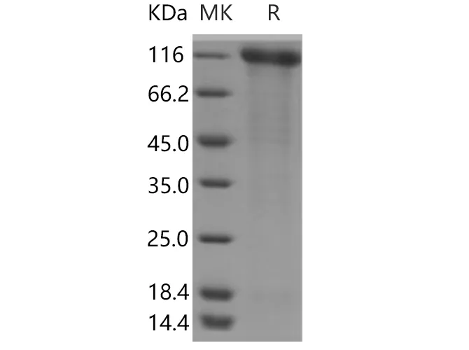 Recombinant Human SELP/selectin P/P-selectin Protein (His Tag) - image 1