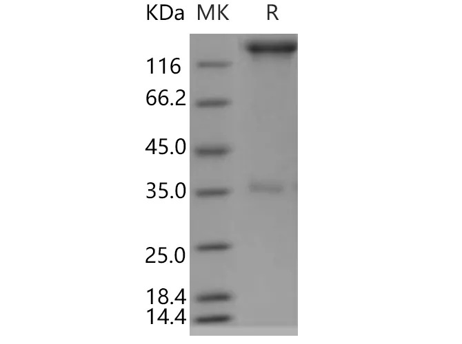 Recombinant Human SELP/selectin P/P-selectin Protein (Fc Tag) - image 1