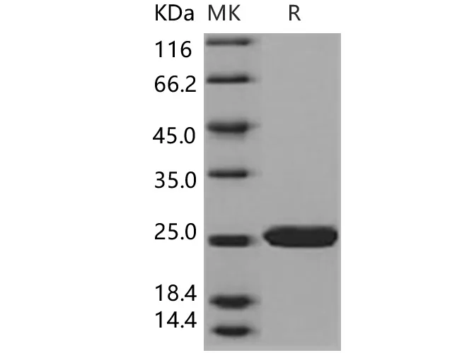 Recombinant Human SOD2/Mn-SOD Protein - image 1