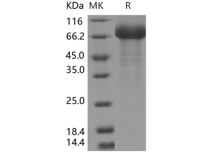 Recombinant Human SIGLEC6/CD327 Protein (Fc Tag) - image 1