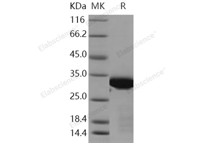 Recombinant Human BCL6/B-cell CLL lymphoma 6 Protein (aa 1-150, His & Trx Tag) - image 1