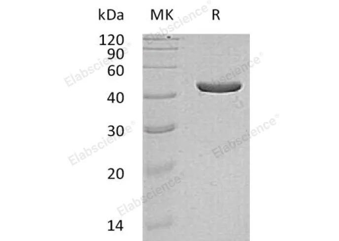 Recombinant Human IDH1 Protein (E.coli, His Tag) - image 1