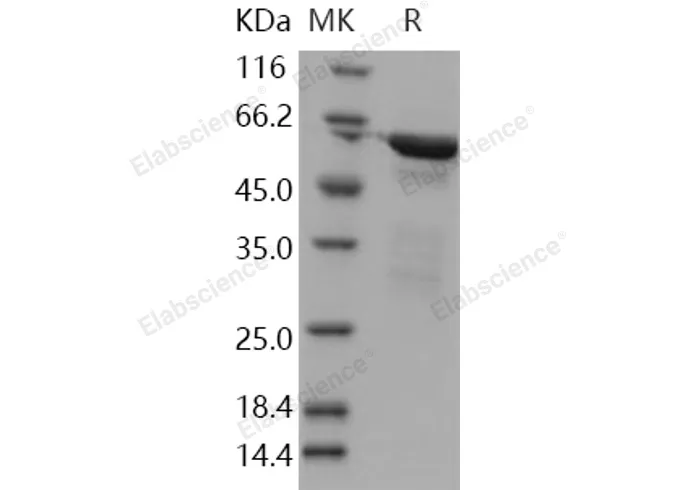 Recombinant Human RELA/Transcription factor p65/NFkB p65 Protein (aa 1-306, GST Tag) - image 1