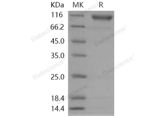 Recombinant Human Semaphorin 4D/SEMA4D Protein (His Tag) - image 1
