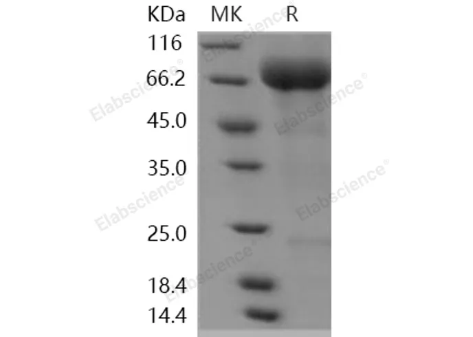 Recombinant Human SIGLEC5 Protein - image 1