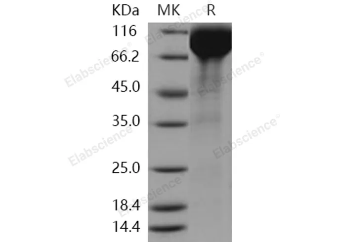 Recombinant Human SIGLEC5 Protein (Fc Tag) - image 1
