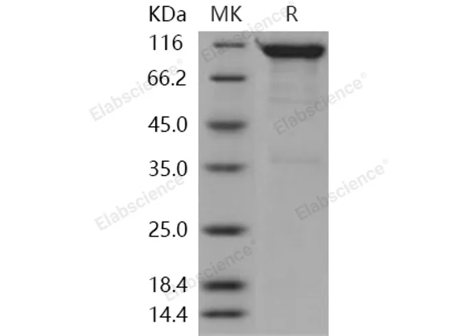 Recombinant Human SEMA4A/Semaphorin B Protein (Fc Tag) - image 1