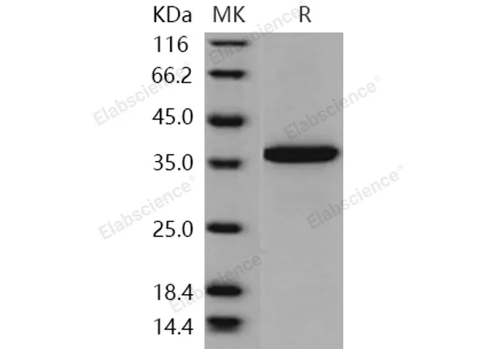 Recombinant Human PDE9A Protein (His Tag) - image 1