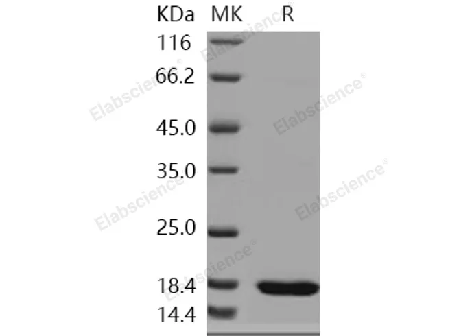 Recombinant Human SETD8/PR-Set7 Protein - image 1