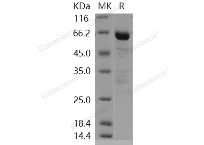 Recombinant Human DCAMKL1 Protein - image 1